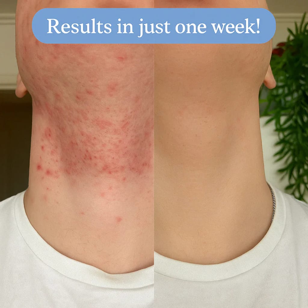 Revolure Ingrown Smoothing Serum